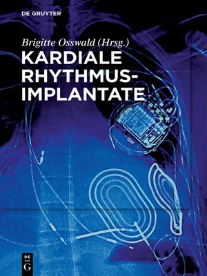 cover image of Kardiale Rhythmusimplantate